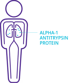 Lung icon inside body silhouette with dots representing Alpha-1 antitrypsin protein.